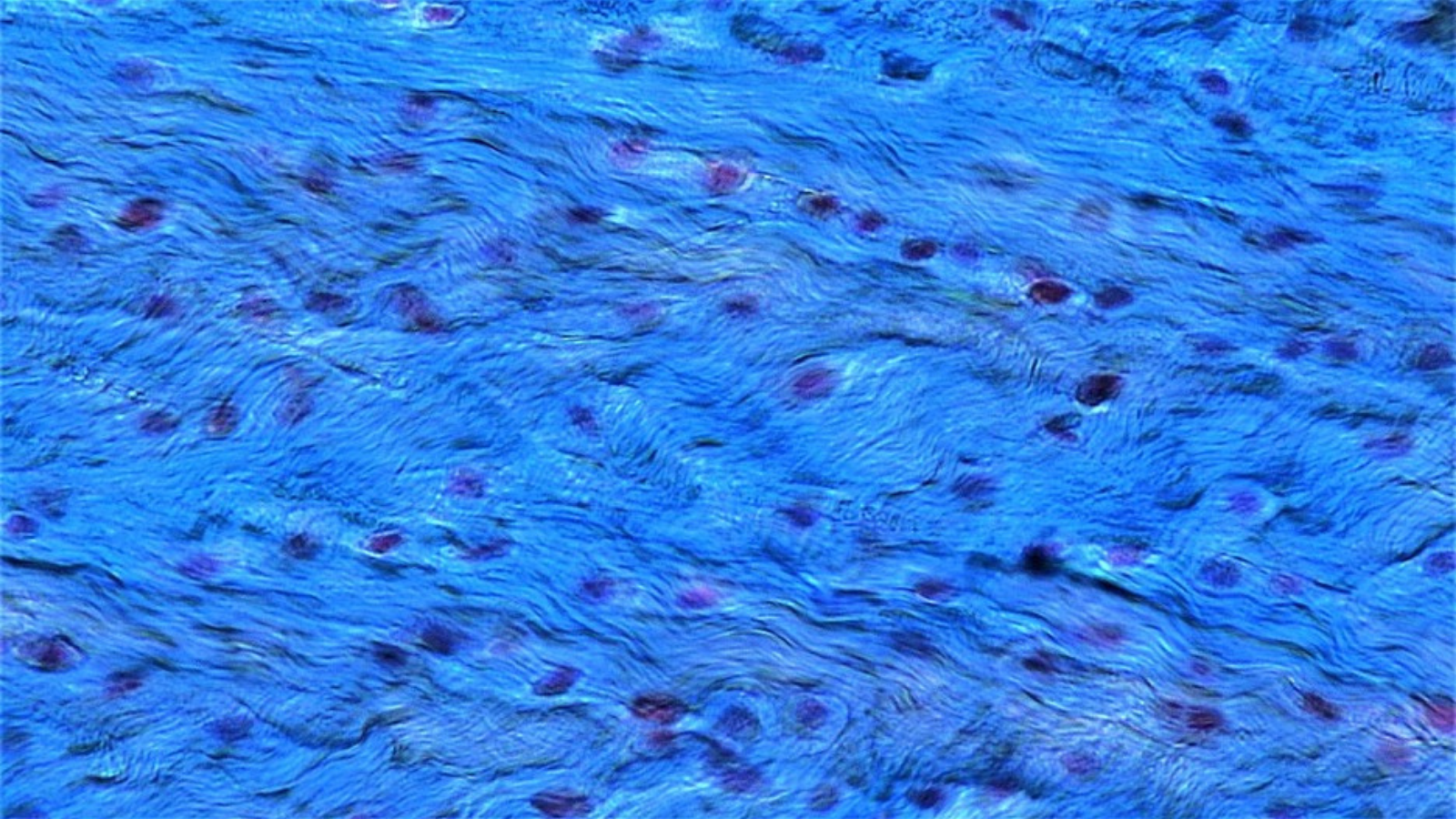 Connective Tissue Fibrocartilage, photo by Berkshire Bioscience Library