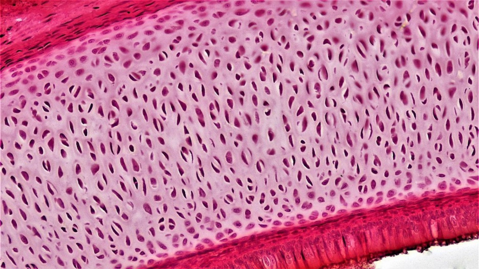 Connective Tissue Hyaline