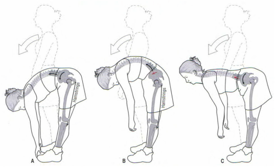 lumbopelvic rhythm, normal rhythm, round-back rhythm, flat-back rhythm , healthy pain free back practices