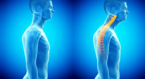 forword head posture can have long term negative health implications
