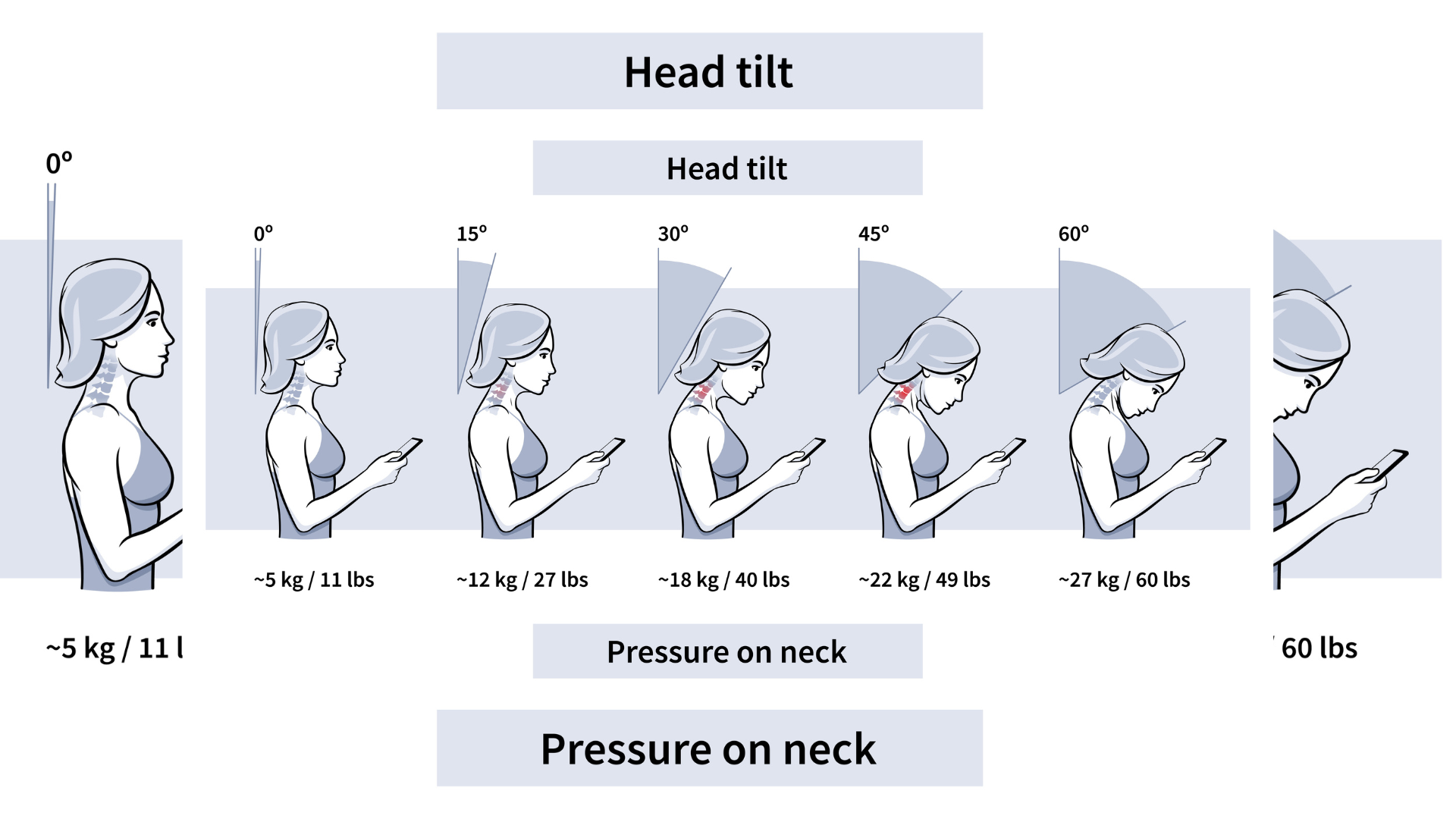 Illustration showing the health dangers of text neck